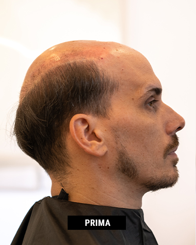 New-Hair-Now-Club-Roma