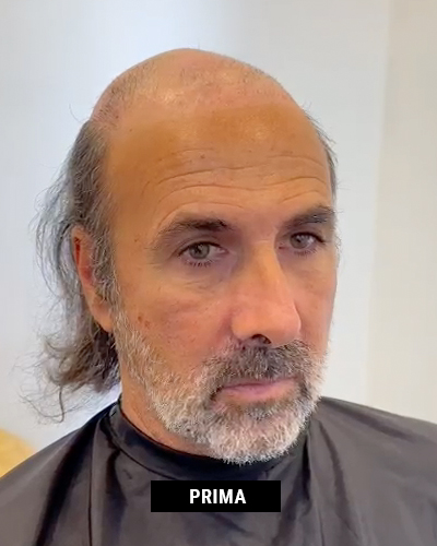 New-Hair-Now-Club-Roma